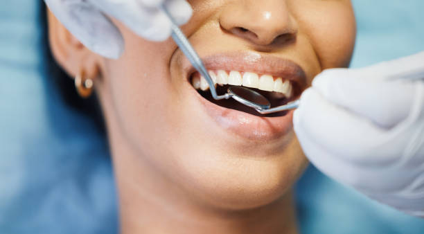 Best Emergency Tooth Extraction in Murfreesboro, NC