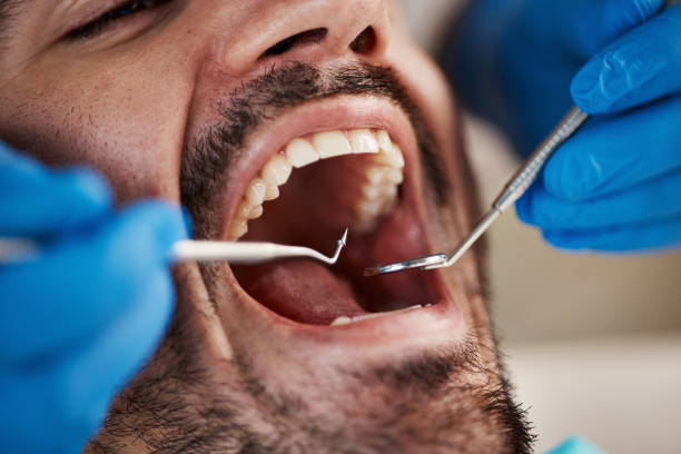 Best Emergency Dental Care for Trauma or Injury in Murfreesboro, NC